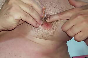 Male nipples playpiercing relative to evzone pins and Foley catheter edict