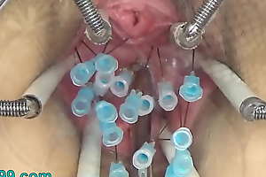 Extreme German BDSM Needles inner Pussy Cervix and Tits