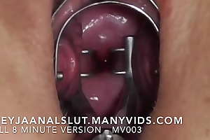 Untrained FreyjaAnalslut : Cervical Spreading - space Freyja's cunt like one another you her tight cervix, and then space Freyja's cervix with a speculum - Full version atop ManyVids